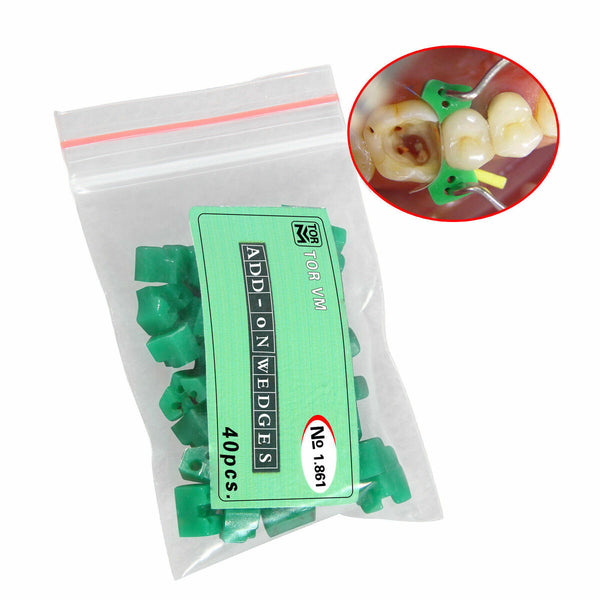 TOR-VM Fixing Wedges 40 pcs